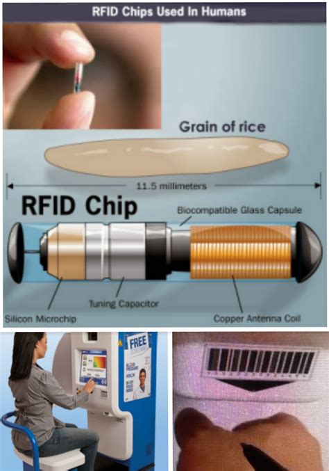 rfid chip american healthcare|Will 'Obamacare' Legislation Implant U.S. Residents with .